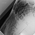 Röntgenbild Pferdeschädel