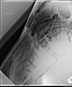 Röntgenbild Pferdeschädel