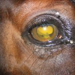 Uveitis Fibrin